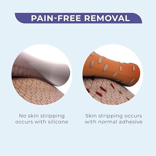 Conkote Pain-Free Removal Silicone Tape 1" x 5 Yards, Strong Adhesion and Hypoallergenic, Good for Sensitive Skin, 2 Rolls
