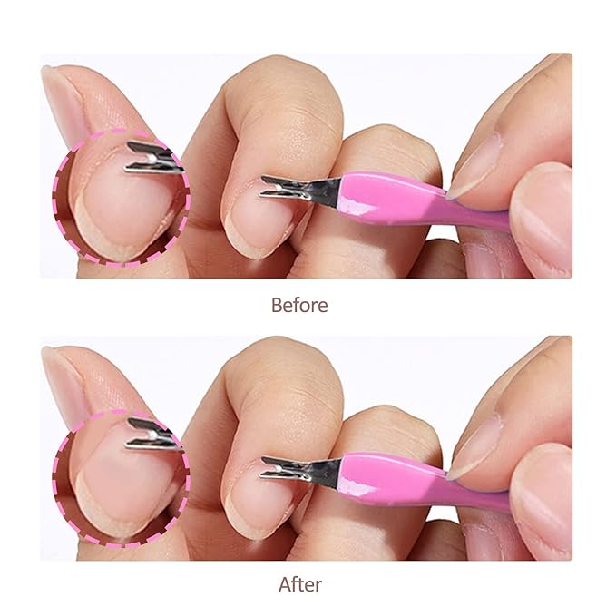 Cuticle knife Trimmer, 24 Pack Cuticle ForkTrimmer Nail Cuticle Remover Trimmer Pusher Dead Skin with Double Head V-Shaped Fork Manicure Pedicure Cleaner Care Tools for Home and Nail Shop (P)