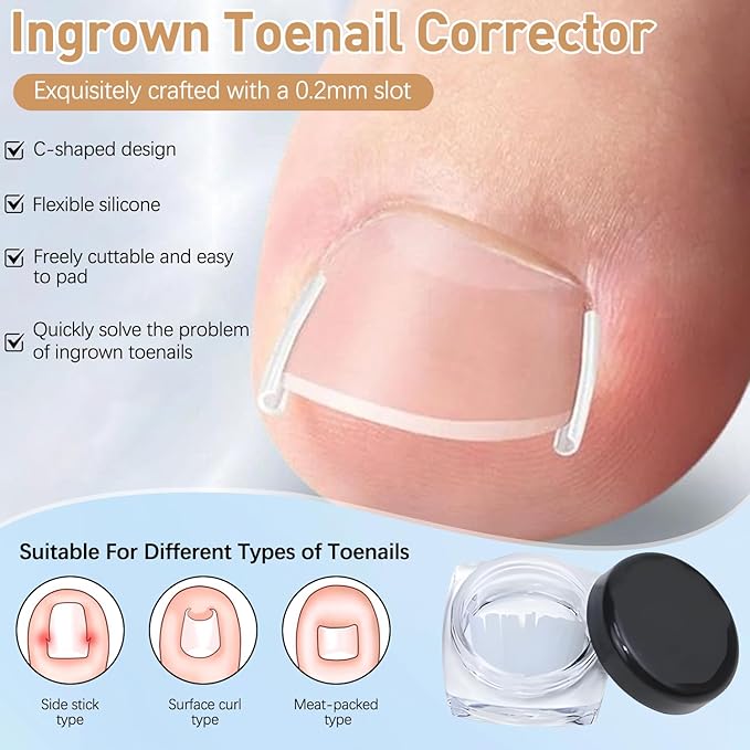 Professional Ingrown Toenail Set with Breathable Ingrown Toenail Strips, Curved Toenails Corrector Patch, Painless File and Lifter Pedicure Tools