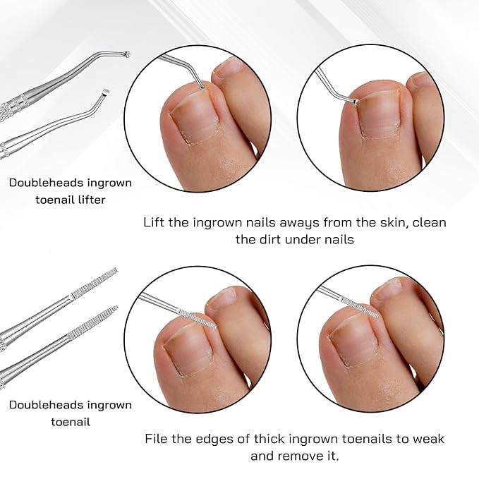 7 Pack Ingrown Toenail Tool Pedicure Tools for Feet, Stainless Steel Toenail Removal Kit, Professional Surgical Manicure Treatment Pedicure Tools for Feet Under Nail Cleaner Correction Polish Pain