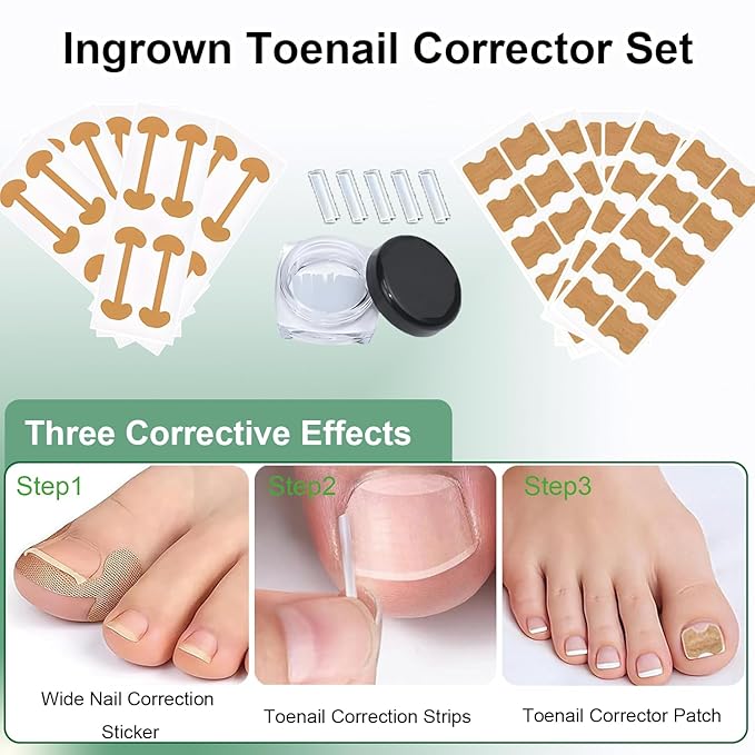 Ingrown Toenail Corrector Set with Correction Strips, Professional Ingrown Toenails Pedicure Tool Set, Painless File and Lifter Pedicure Tools Pedicure Tools, Ingrown Nail Tool for Women Man