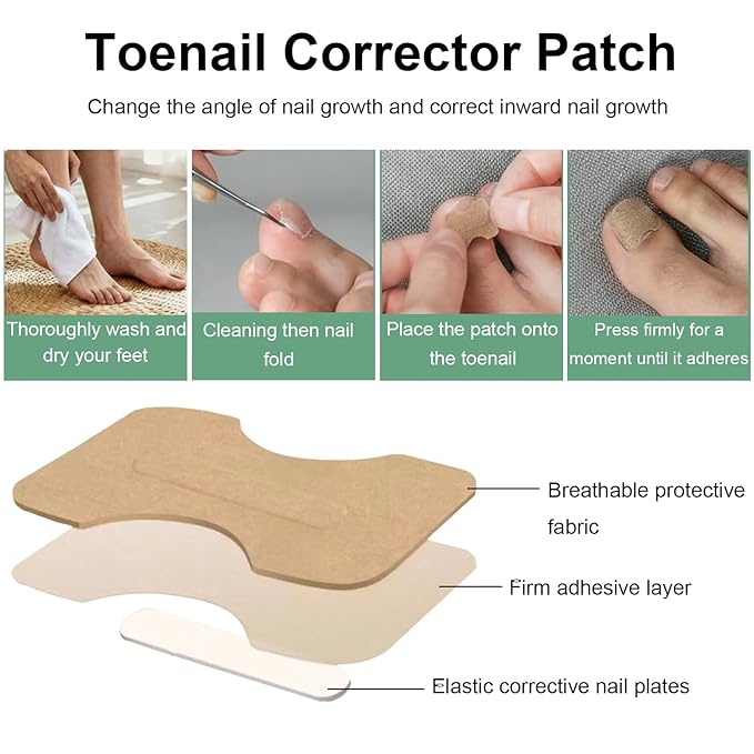 Ingrown Toenail Corrector Set with Correction Strips, Professional Ingrown Toenails Pedicure Tool Set, Painless File and Lifter Pedicure Tools Pedicure Tools, Ingrown Nail Tool for Women Man