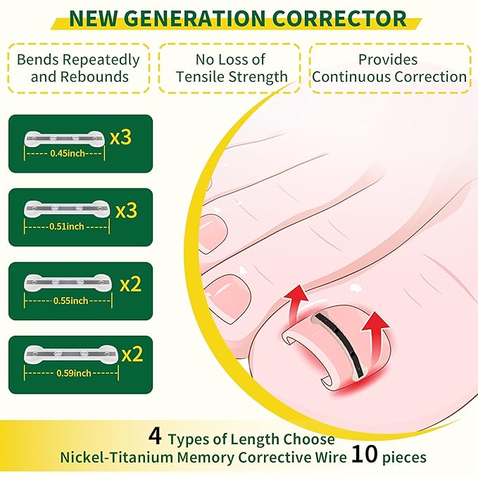 Small Size-Titanium Alloy Ingrown Toenail Treatment & Removal Kit for Quick Relief, Ingrown Toenail Removal Kit竊?Professional Ingrown Toenail Corrector, Ingrown Toenail Tools for Quick Relief, 10 Pcs