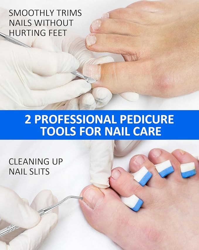 Ingrown Toenail Correction Treatment Tool, 64Pcs Breathable Ingrown Toenail Strips in 3 Types, No Glue Safe Ingrown Toenail Tool with 2 Pedicure Tools for Ingrown Toenail Remover