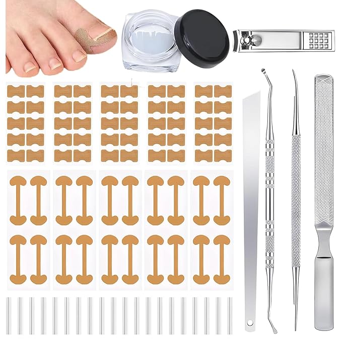 Ingrown Toenail Corrector Set with Correction Strips, Professional Ingrown Toenails Pedicure Tool Set, Painless File and Lifter Pedicure Tools Pedicure Tools, Ingrown Nail Tool for Women Man