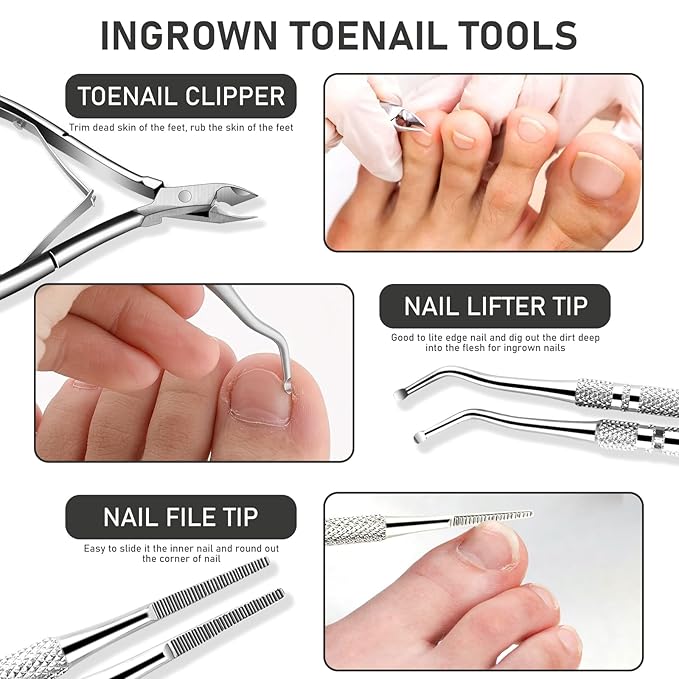 Ingrown Toenail Tool Kit, Ingrown Toenail Removal Kit: Ingrown Toenail Clippers, Ingrown Toenail File and Lifters, Under Nail Cleaner - Professional Pedicure Tools Set for Effective Treatment