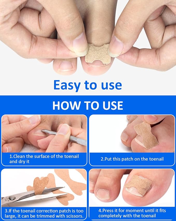 Ingrown Toenail Correction Treatment Tool, 64Pcs Breathable Ingrown Toenail Strips in 3 Types, No Glue Safe Ingrown Toenail Tool with 2 Pedicure Tools for Ingrown Toenail Remover