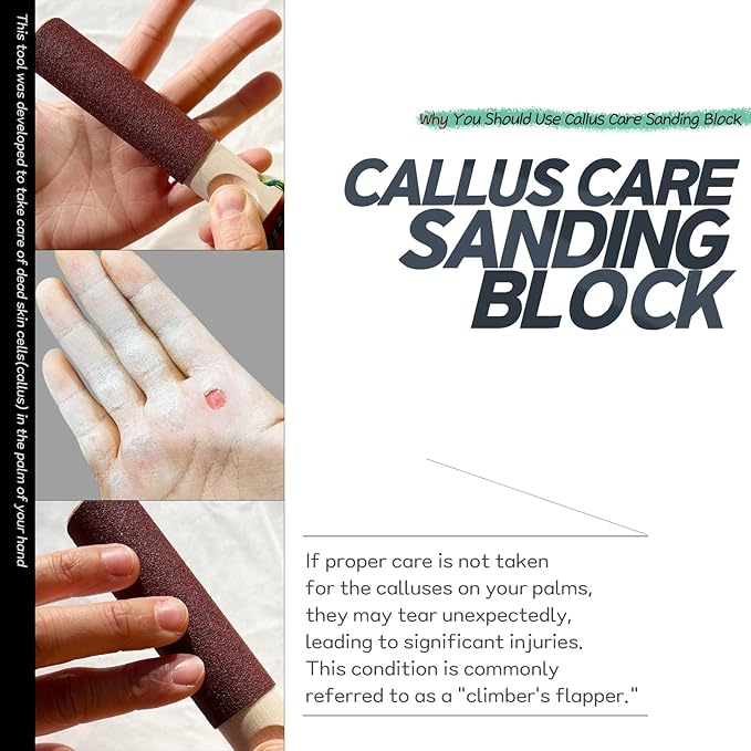 Callus Care Sanding Block - Prevent Climbers' Flapper - Cylindrical Palm Skin Smoother for Rock & Gym Climbers with Extra Sandpaper - Easy Grip