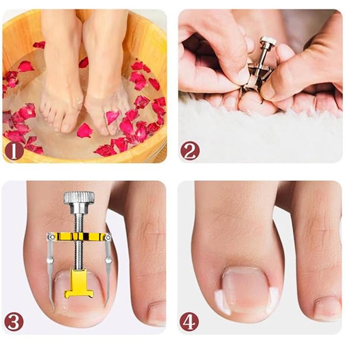 Ingrown Toenail Clipper Pedicure Tools for Feet Thick Nails Toenail Removal Kit Callus Pedicure Knife Nail Cutter Toenail Clippers for Thick Toenails for Seniors