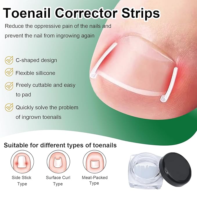 Ingrown Toenail Corrector Set with Correction Strips, Professional Ingrown Toenails Pedicure Tool Set, Painless File and Lifter Pedicure Tools Pedicure Tools, Ingrown Nail Tool for Women Man
