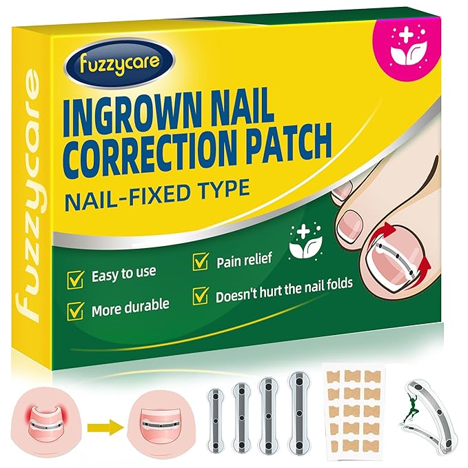 Small Size-Titanium Alloy Ingrown Toenail Treatment & Removal Kit for Quick Relief, Ingrown Toenail Removal Kit竊?Professional Ingrown Toenail Corrector, Ingrown Toenail Tools for Quick Relief, 10 Pcs