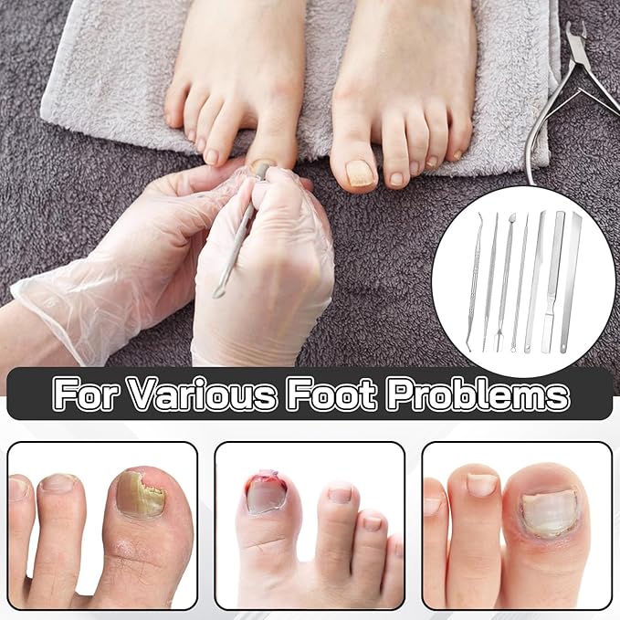 7 Pack Ingrown Toenail Tool Pedicure Tools for Feet, Stainless Steel Toenail Removal Kit, Professional Surgical Manicure Treatment Pedicure Tools for Feet Under Nail Cleaner Correction Polish Pain