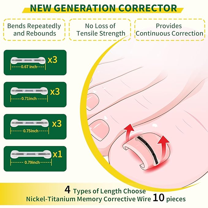 Large Size-Titanium Alloy Ingrown Toenail Treatment & Removal Kit for Quick Relief, Ingrown Toenail Removal Kit竊?Professional Ingrown Toenail Corrector, Ingrown Toenail Tools for Quick Relief, 10 Pcs