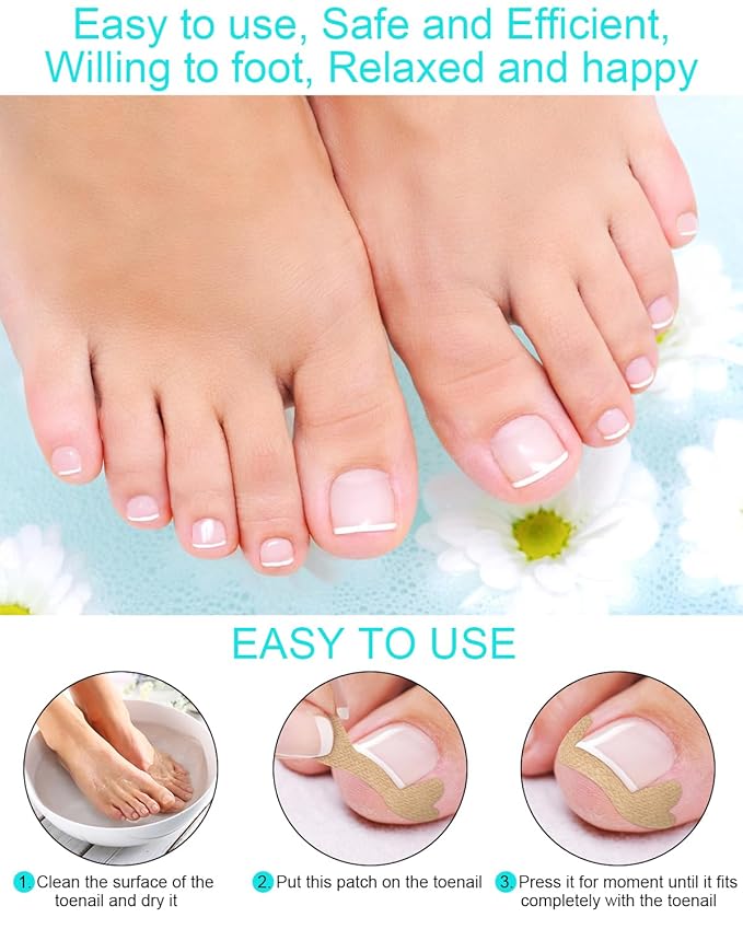 Ingrown Toenail Correction Treatment Tool, 60Pcs Ingrown Toe nail Corrector Patch in 2 Types, Professional Safe Ingrown Toenail Tool with 2 Pedicure Tools for Ingrown Toenail Remover