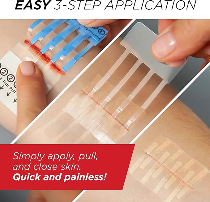 Clozex Emergency Laceration Closures - Repair Wounds Without Stitches, FSA HSA Eligible Skin Closure Device for 3 Individual Wounds Or Combine for Total Length of 3 3/8 Inches